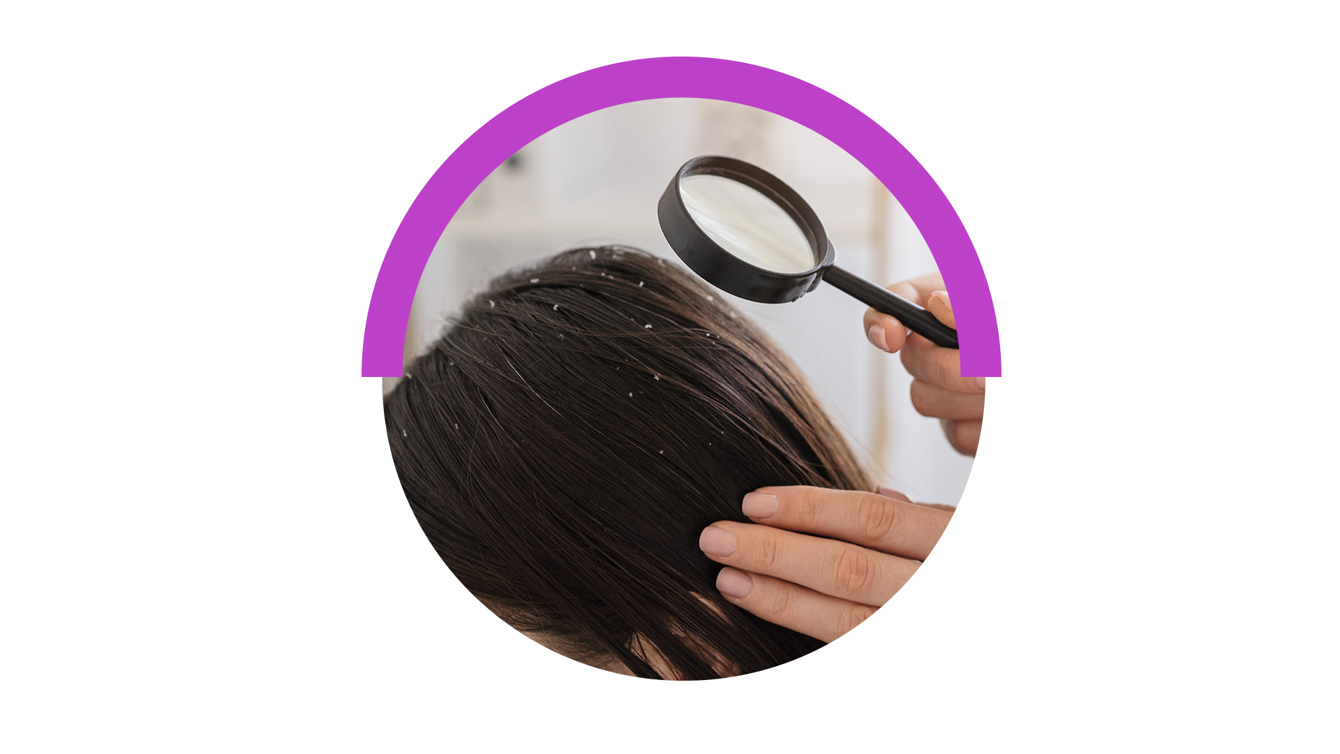 Anti Dandruff Treatment